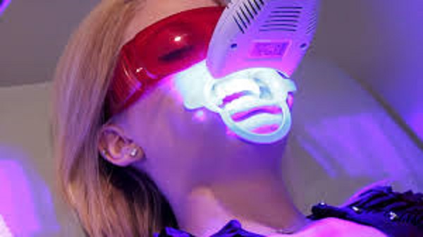 Tẩy trắng răng bằng tia laser nhanh chóng, hiệu quả, tuy nhiên cần có những biện pháp an toàn và thuốc tẩy phải phù hợp, chất lượng