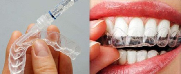 Sử dụng lượng thuốc vừa đủ, đúng cách để an toàn hiệu quả khi tẩy trắng răng tại nhà