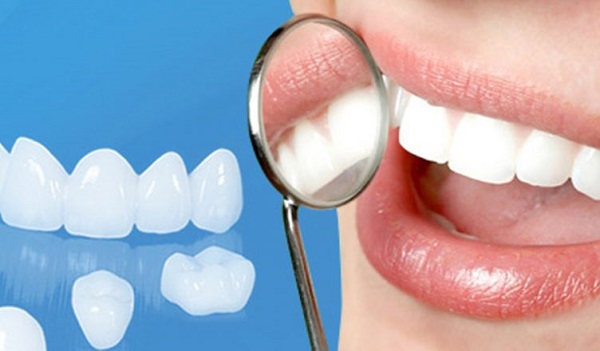 Phục hình răng phù hợp cho những ai có khiếm khuyết răng nhỏ
