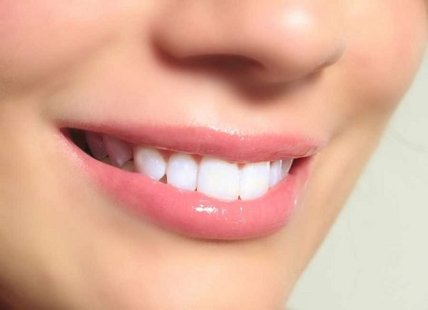 Chăm sóc răng sứ Zolid đúng cách sau điều trị