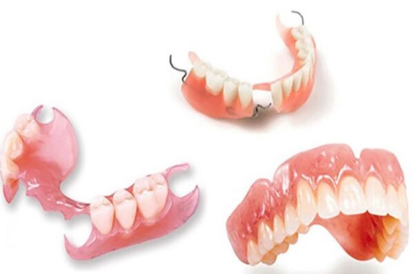 Các loại răng hàm giả
