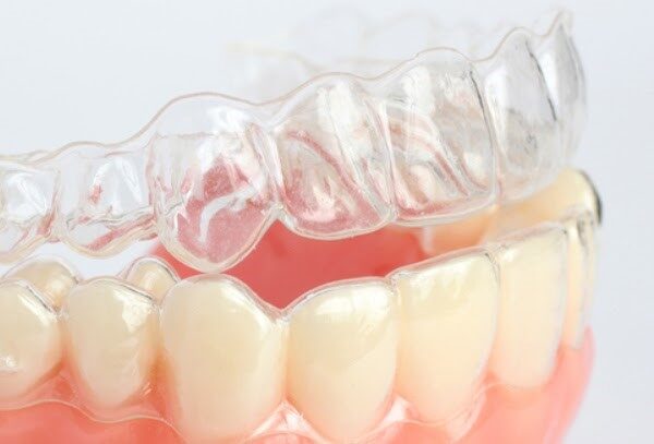 Khay niềng an toàn, dễ dàng tháo lắp vệ sinh khi cần thiết