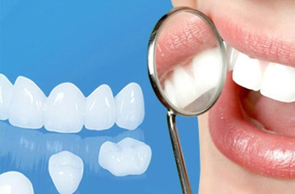 Chi phí lắp đặt răng sứ Zirconia có giá nhỉnh hơn các loại răng khác