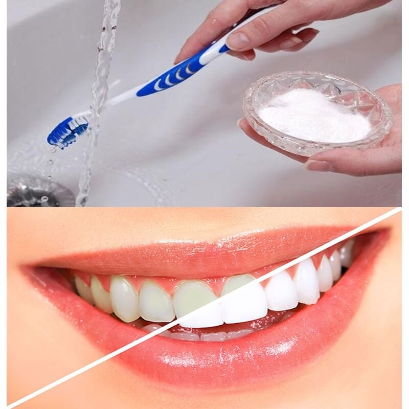 làm sạch răng và những điều cần lưu ý