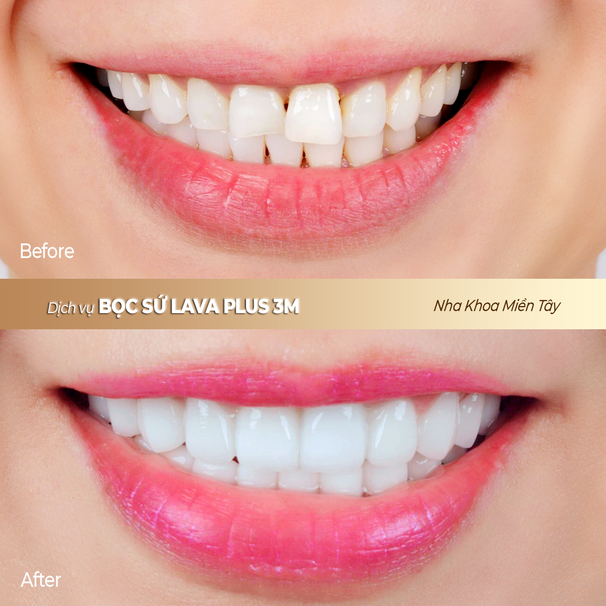 BOC SU LAVA PLUS 3M