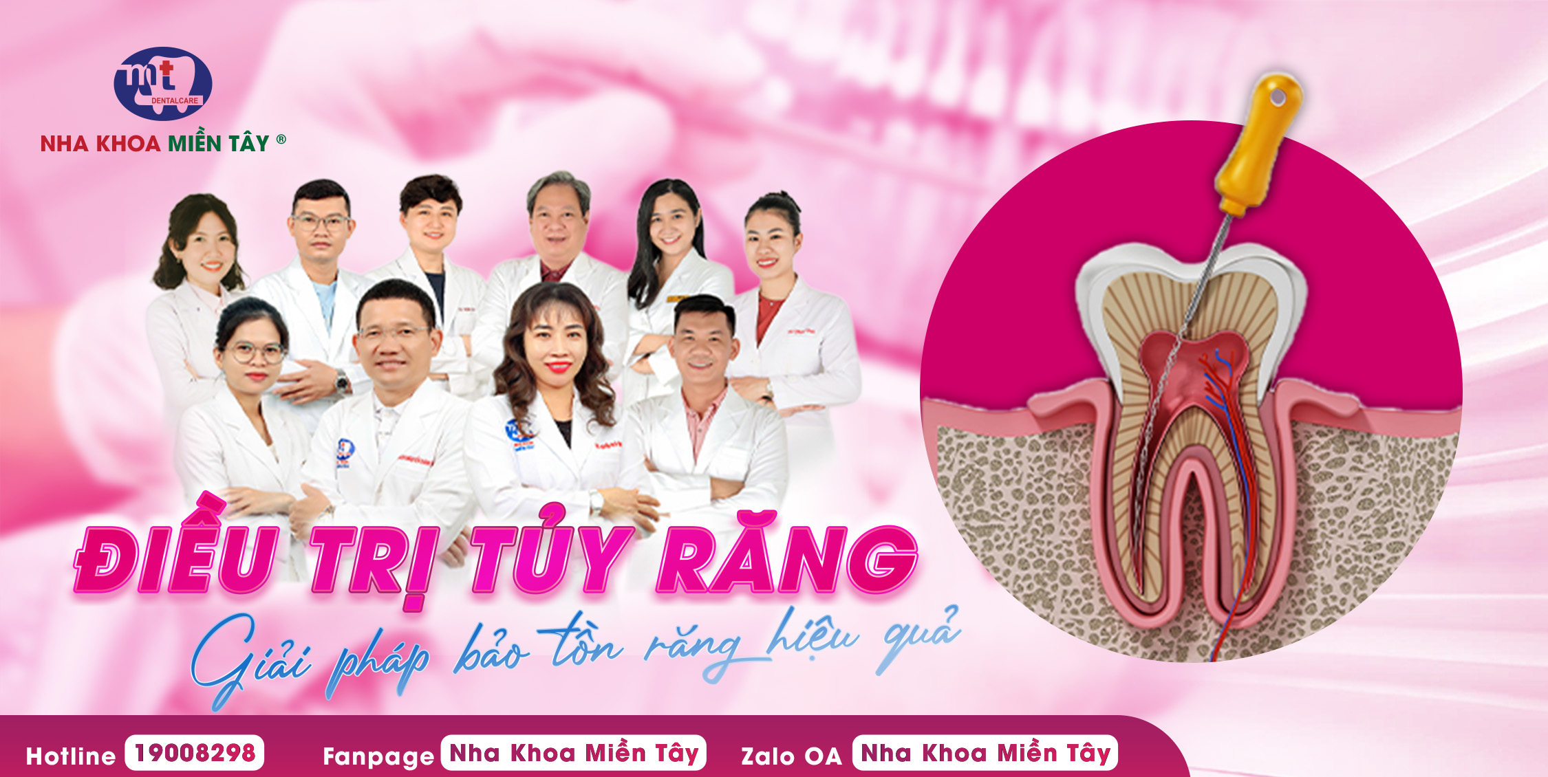 Điều trị tủy răng (1)