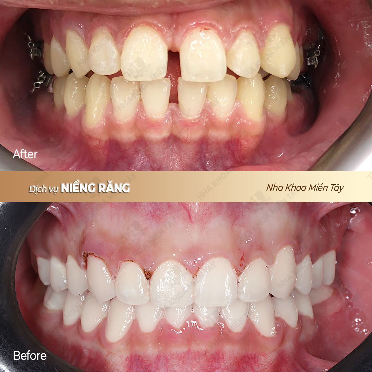 THANH PHU copy 2