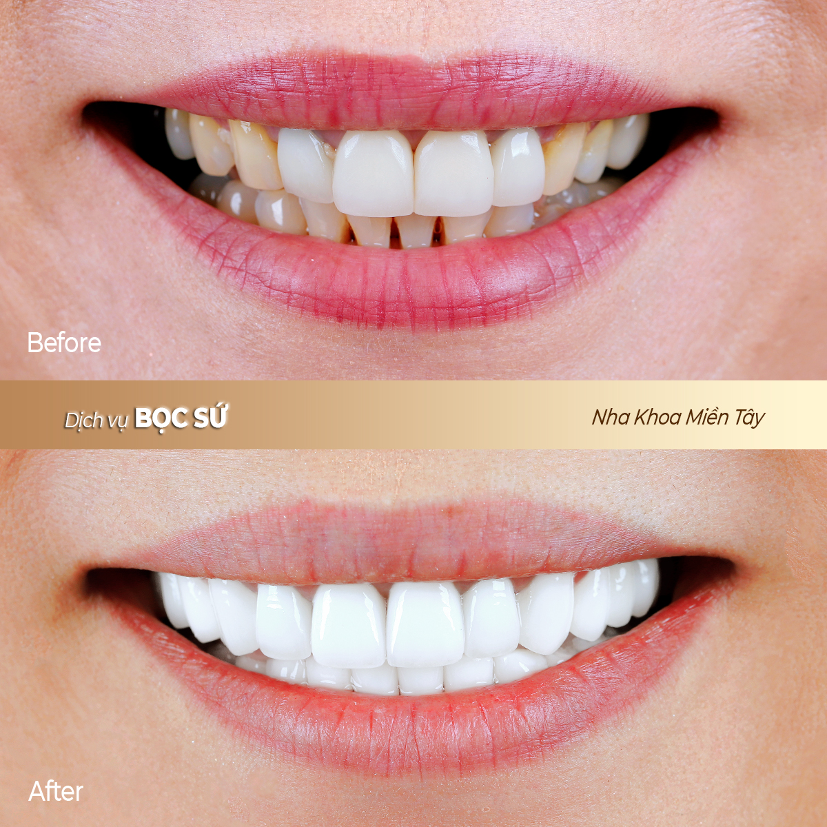 ca 5 copy - Copy