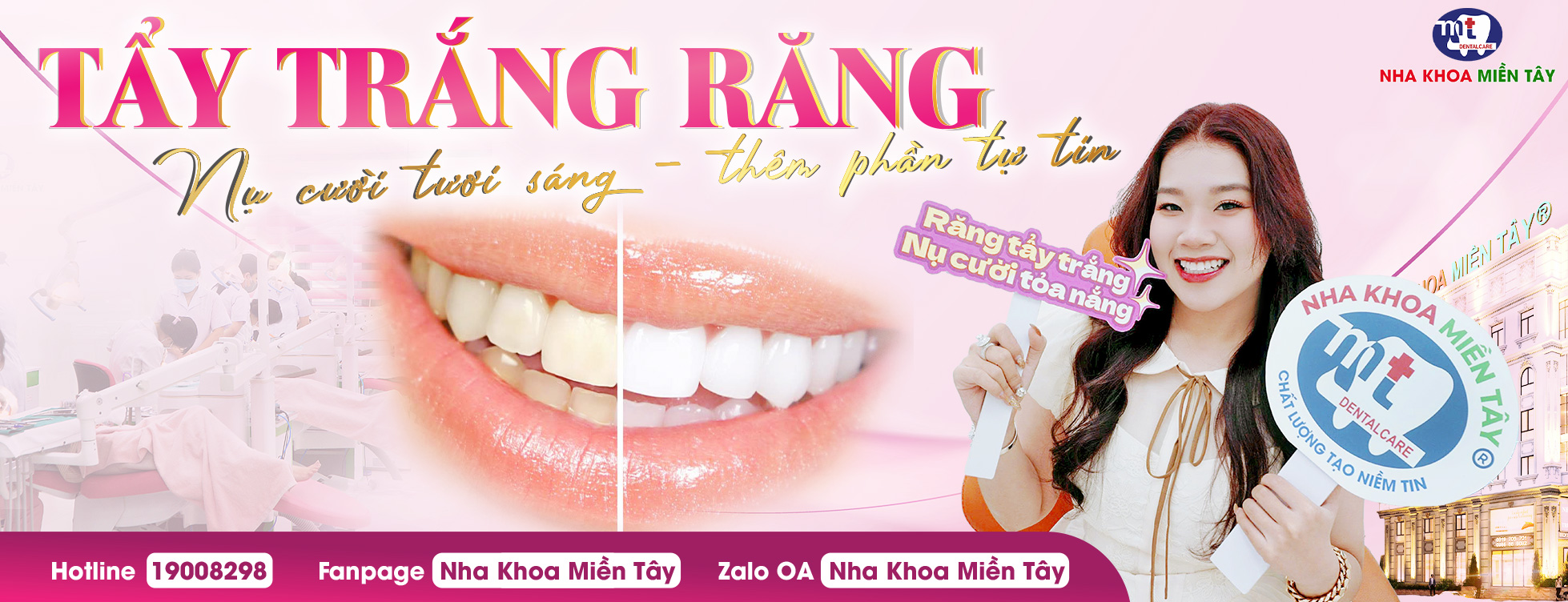 Dịch vụ tẩy trắng răng tại nha khoa miền tây